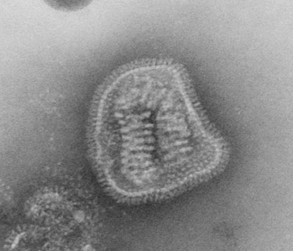 вирус грипа - велико увећање (извор: Википедија)